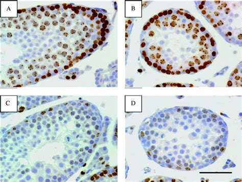 Loss of Bmyc results in increased apoptosis associated with .